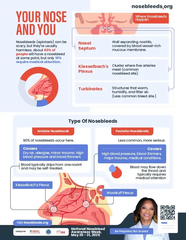 Understanding Nosebleeds